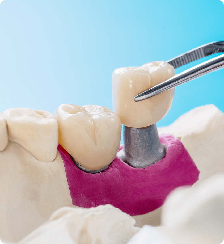 Dental Patient Smiling