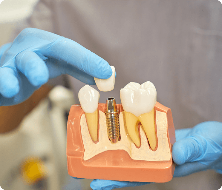 Hero Mobile Background