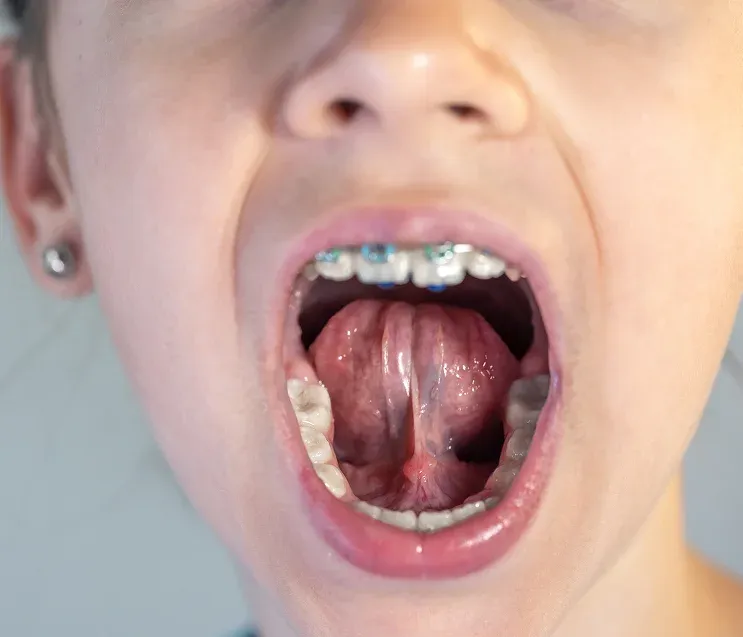 Hero Mobile Background