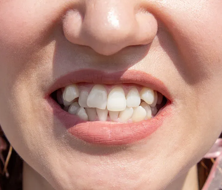 Hero Mobile Background