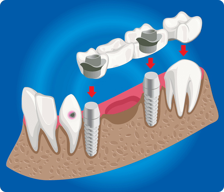 Hero Mobile Background