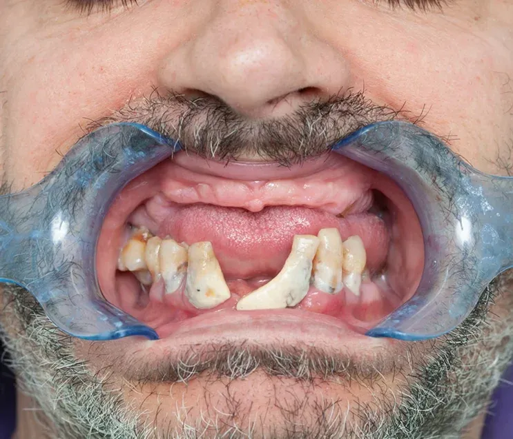 Hero Mobile Background