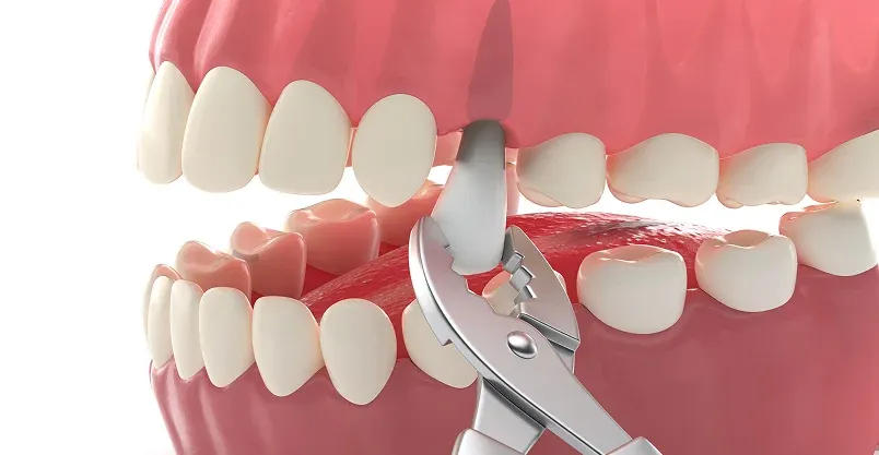 Happy patient pointing to smile