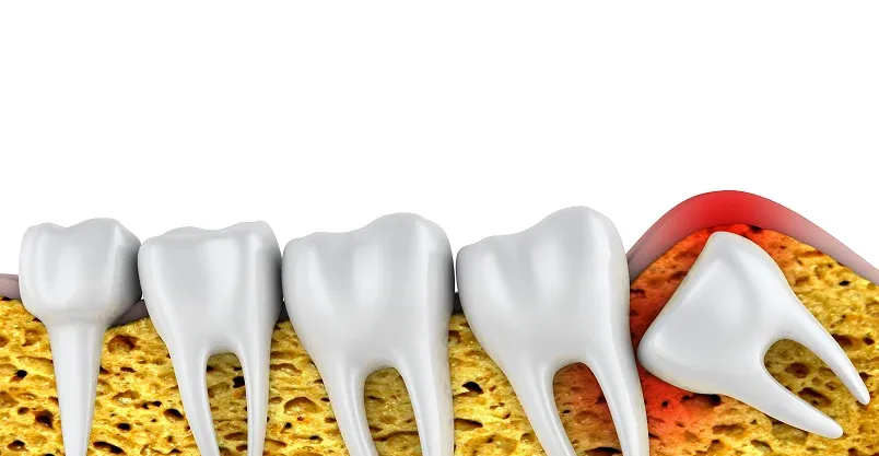 Happy patient pointing to smile
