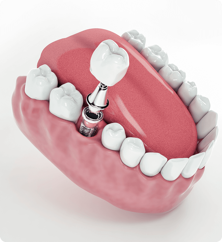 Dental Patient Smiling