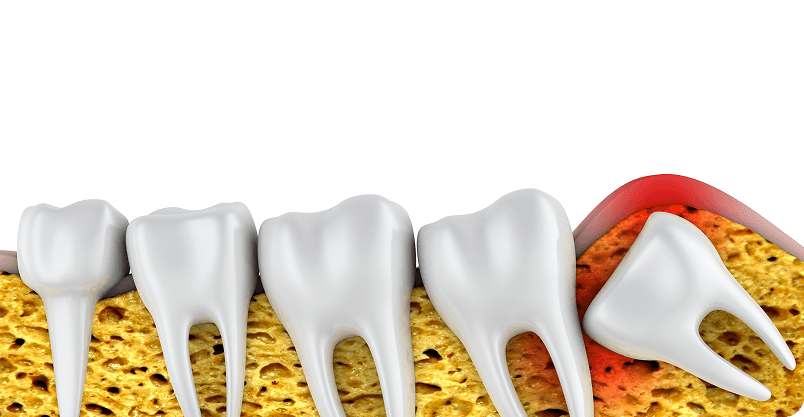 Happy patient pointing to smile
